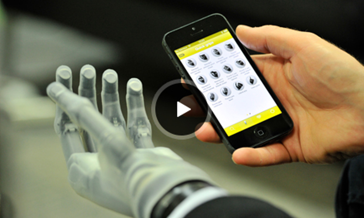 Prosthetic Bionic Hand