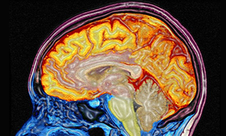 Magnetic Resonance Imaging (MRI)