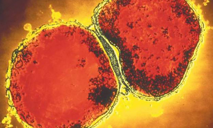 Laser Fingerprinting of Meningitis