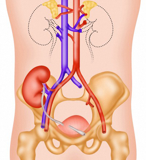 Cut away image of kidney